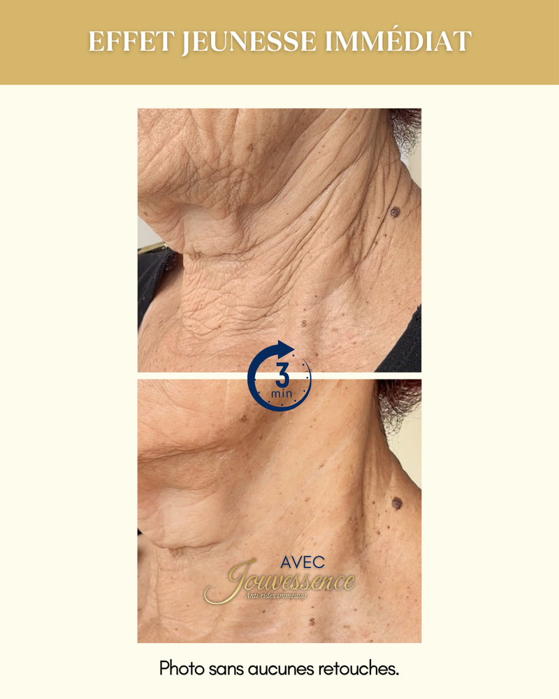 Jouvessence 30 ml Anti-rides/poches immédiat 3 minutes :