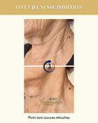 Jouvessence 15 ml Anti-rides/poches immédiat 3 minutes :